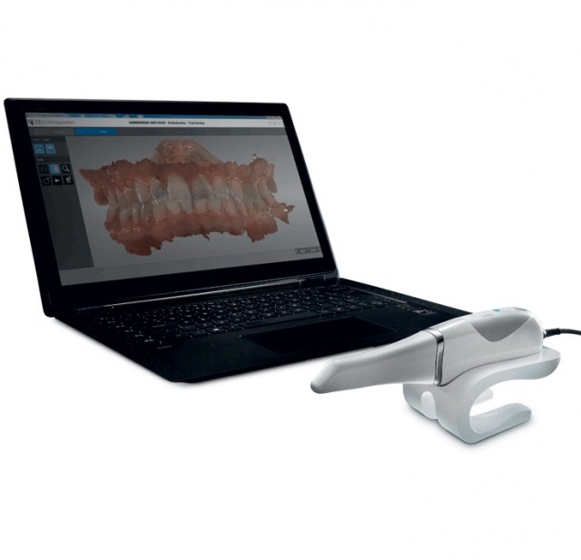 Scanner intraorale digitale